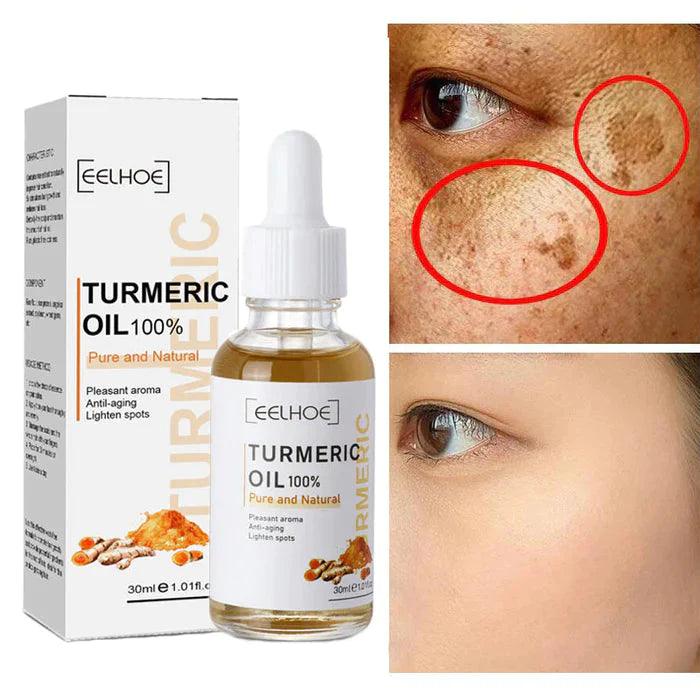 Turmeric™ Óleo Anti-Idade Removedor de Manchas (Até 33% De Desconto) - Líder Vendas