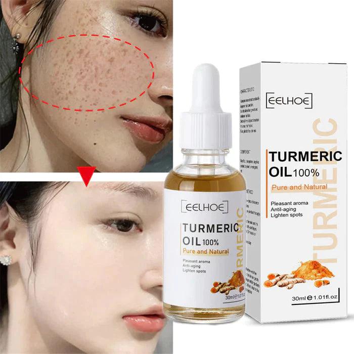 Turmeric™ Óleo Anti-Idade Removedor de Manchas (Até 33% De Desconto) - Líder Vendas